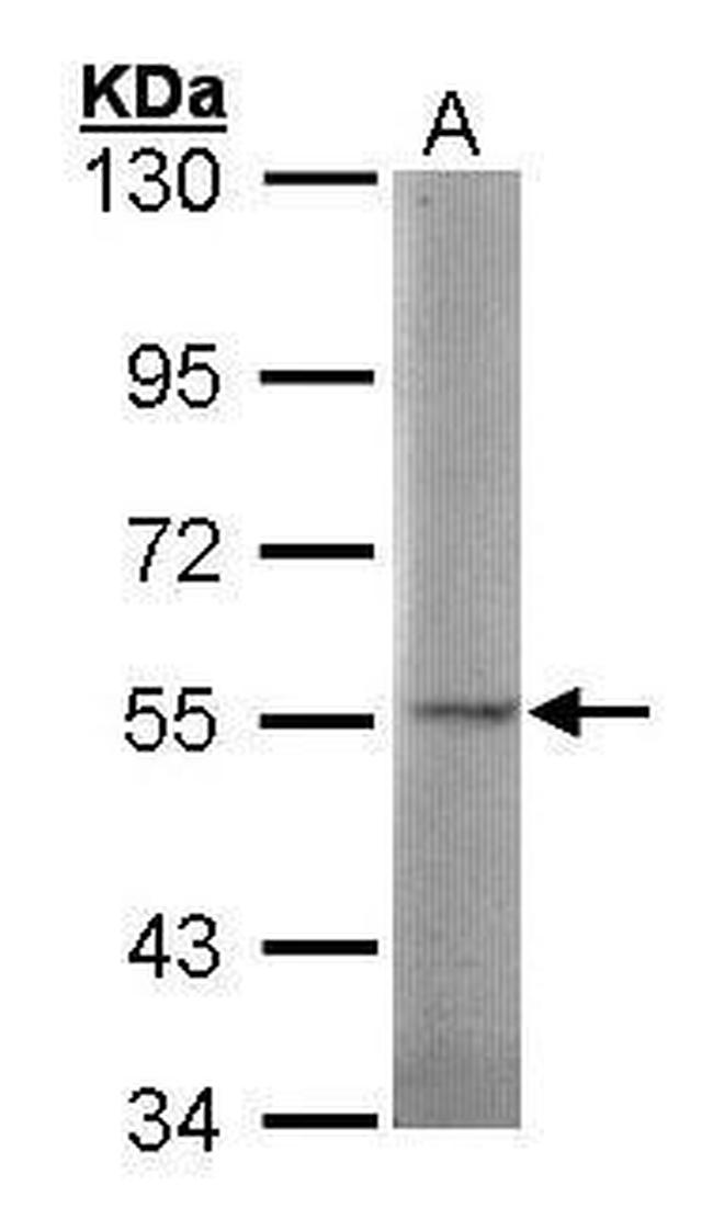 SGSH Antibody in Western Blot (WB)