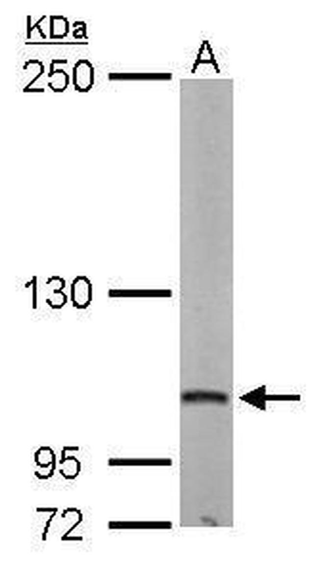 DAP5 Antibody in Western Blot (WB)