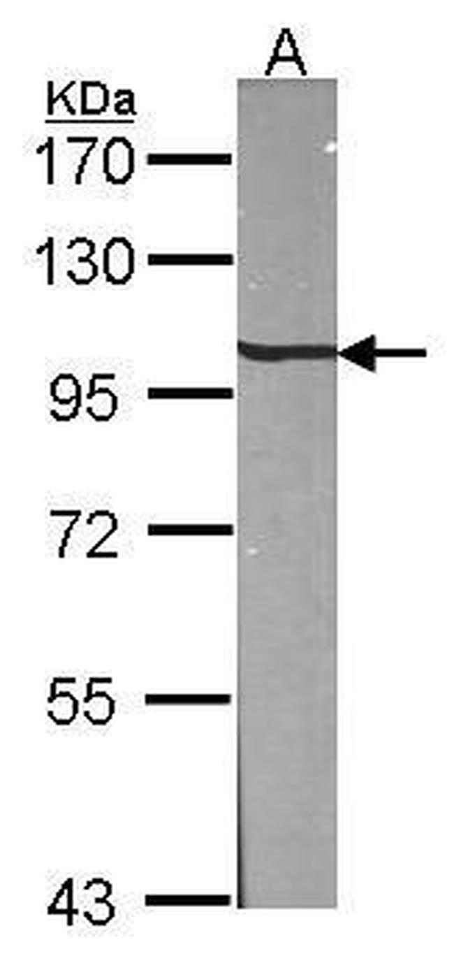 beta-1 Adaptin Antibody in Western Blot (WB)