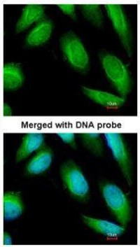 Creatine Kinase BB Antibody in Immunocytochemistry (ICC/IF)