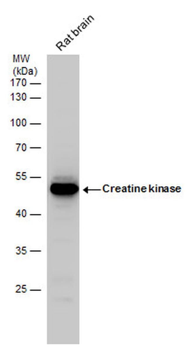 Creatine Kinase BB Antibody in Western Blot (WB)