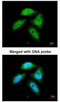 CtBP1 Antibody in Immunocytochemistry (ICC/IF)