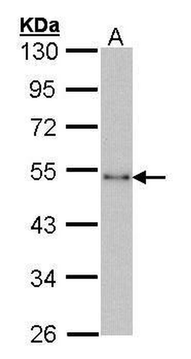 CtBP1 Antibody in Western Blot (WB)