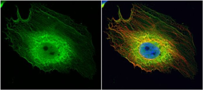 ENO1 Antibody in Immunocytochemistry (ICC/IF)