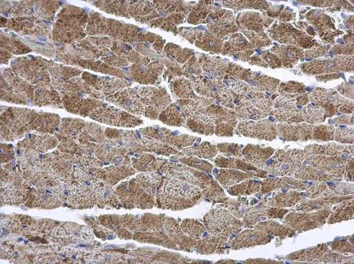 ENTPD6 Antibody in Immunohistochemistry (Paraffin) (IHC (P))