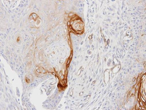 ENTPD6 Antibody in Immunohistochemistry (Paraffin) (IHC (P))