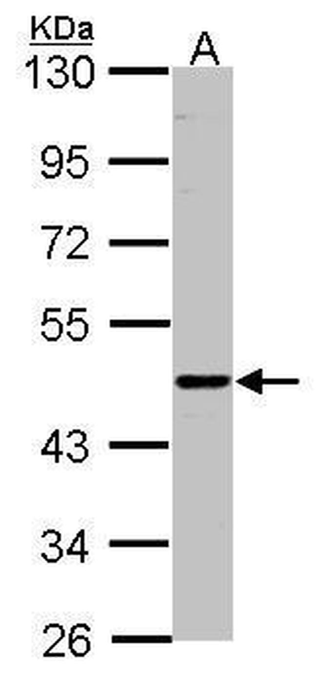 ENTPD6 Antibody in Western Blot (WB)