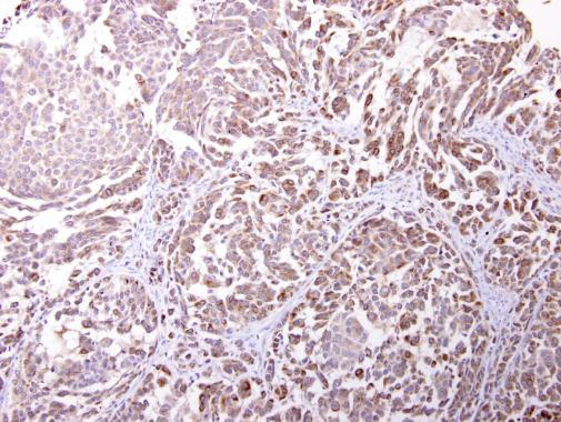 Endomucin Antibody in Immunohistochemistry (Paraffin) (IHC (P))