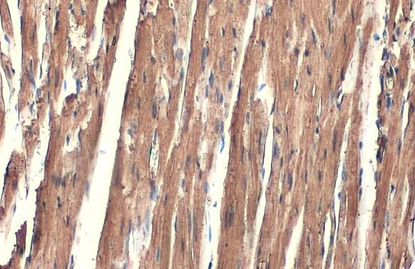 alpha-Cardiac Actin Antibody in Immunohistochemistry (Paraffin) (IHC (P))