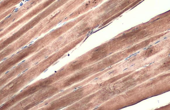 alpha-Cardiac Actin Antibody in Immunohistochemistry (Paraffin) (IHC (P))