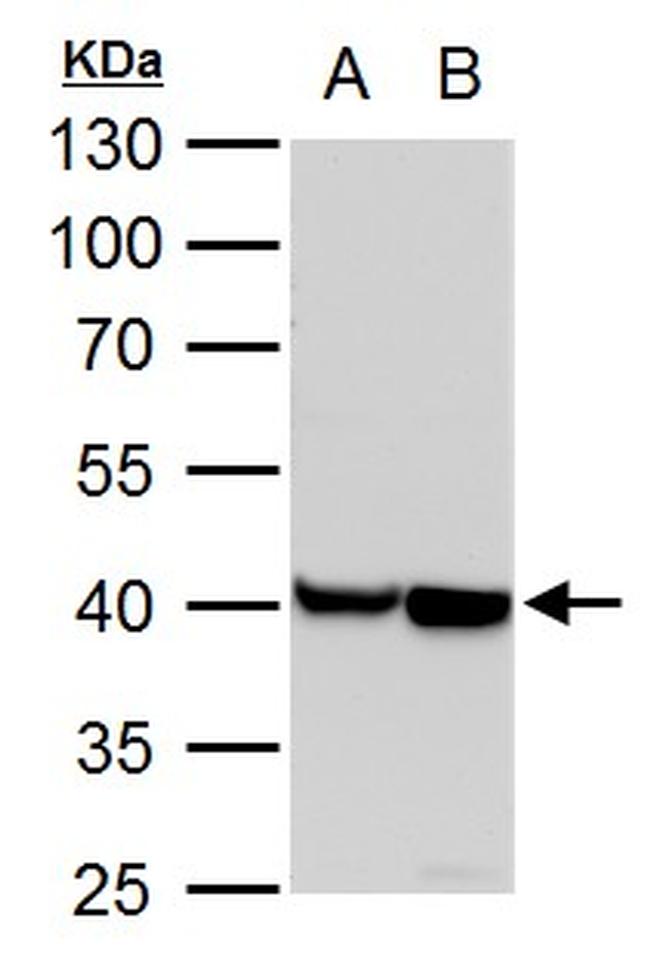 alpha-Cardiac Actin Antibody in Western Blot (WB)