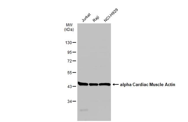 alpha-Cardiac Actin Antibody in Western Blot (WB)