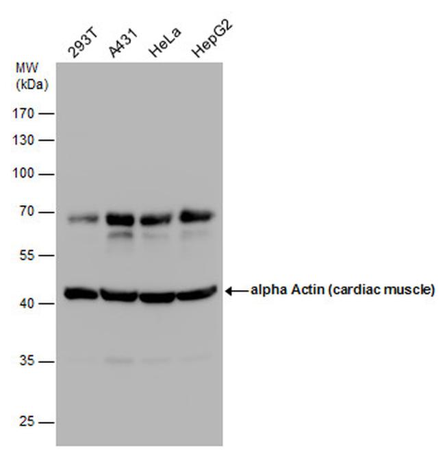 alpha-Cardiac Actin Antibody in Western Blot (WB)