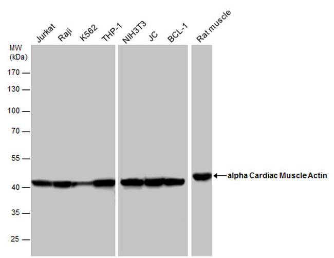 alpha-Cardiac Actin Antibody in Western Blot (WB)