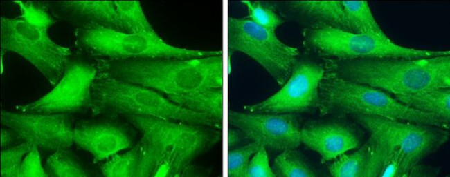 GAD67 Antibody in Immunocytochemistry (ICC/IF)