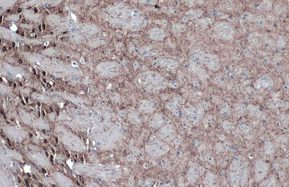 GAD67 Antibody in Immunohistochemistry (Paraffin) (IHC (P))