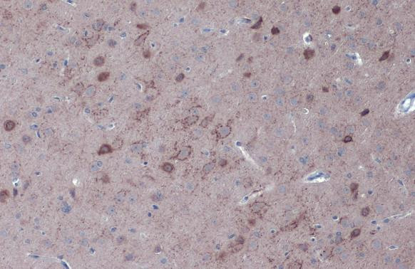 GAD67 Antibody in Immunohistochemistry (Paraffin) (IHC (P))