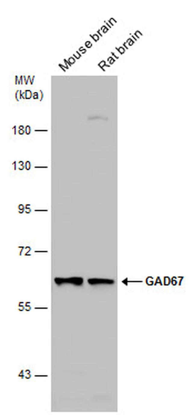 GAD67 Antibody in Western Blot (WB)