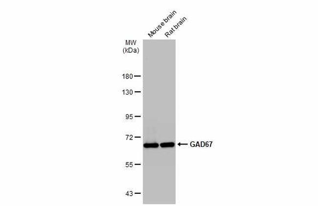 GAD67 Antibody in Western Blot (WB)