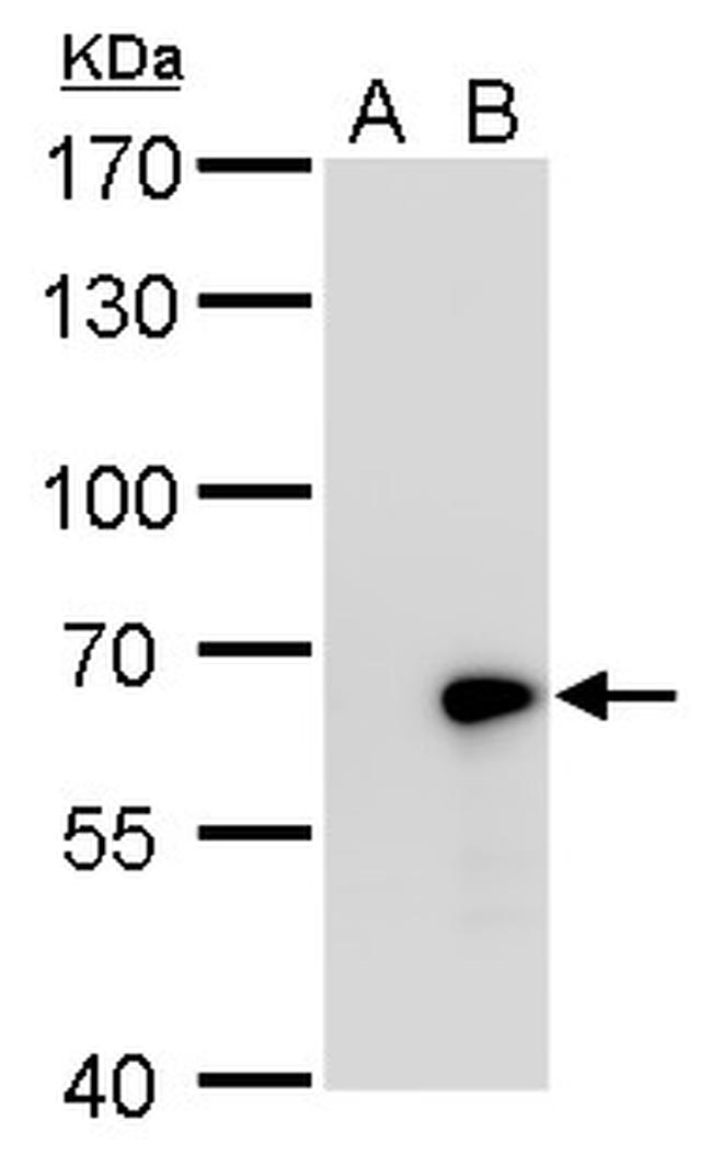 GAD67 Antibody in Western Blot (WB)