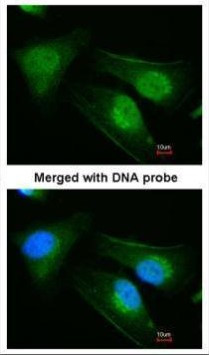 DNAJB6 Antibody in Immunocytochemistry (ICC/IF)