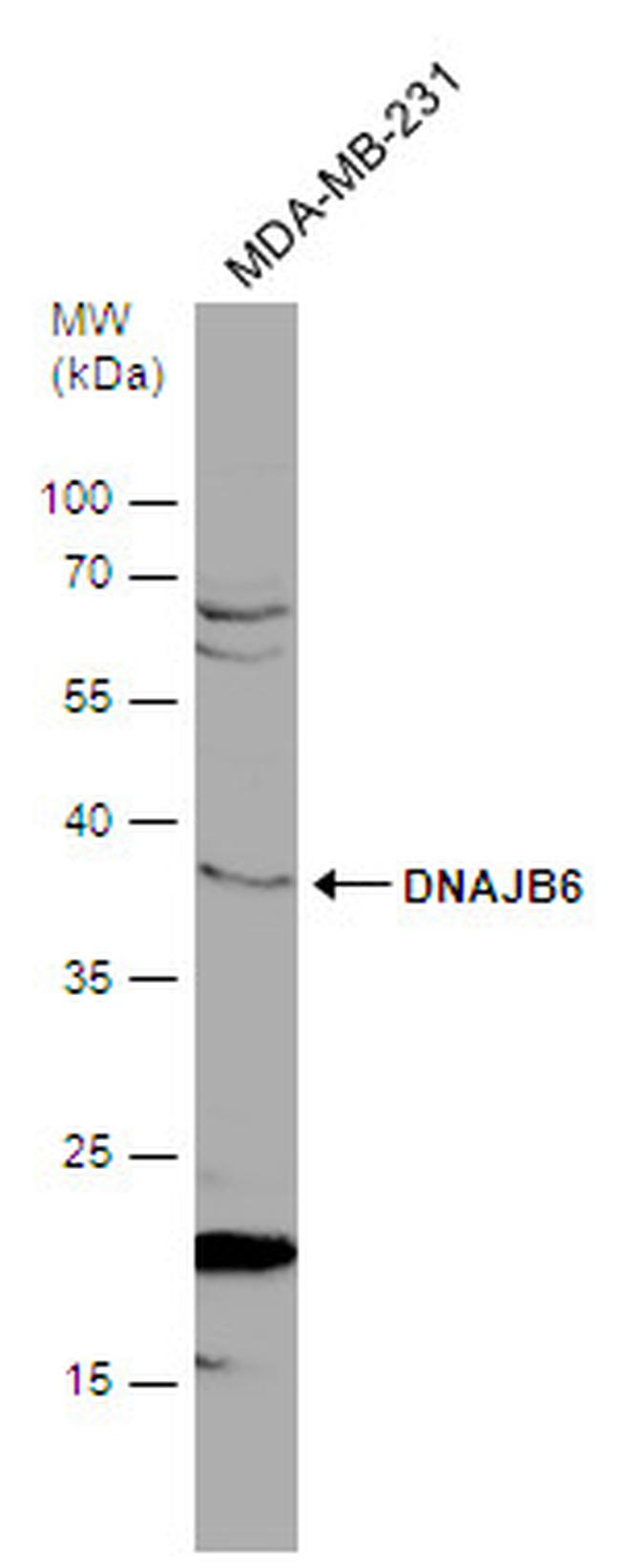 DNAJB6 Antibody in Western Blot (WB)