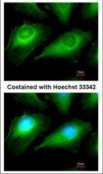 OTUB1 Antibody in Immunocytochemistry (ICC/IF)