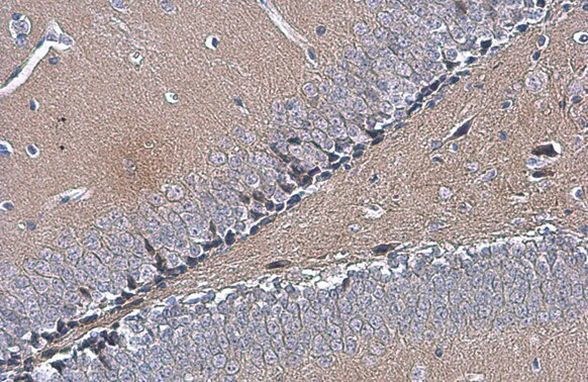 OTUB1 Antibody in Immunohistochemistry (Paraffin) (IHC (P))