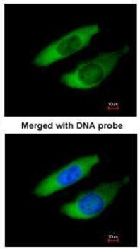 ARPC2 Antibody in Immunocytochemistry (ICC/IF)