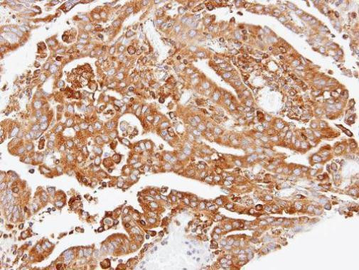 ARPC2 Antibody in Immunohistochemistry (Paraffin) (IHC (P))