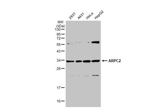 ARPC2 Antibody in Western Blot (WB)