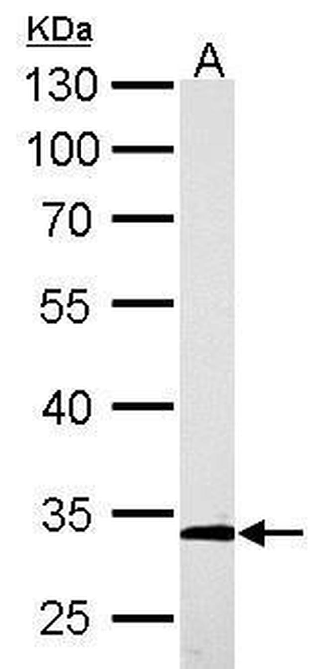 ARPC2 Antibody in Western Blot (WB)