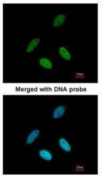 TAP Antibody in Immunocytochemistry (ICC/IF)