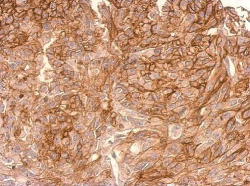 ADAMTSL2 Antibody in Immunohistochemistry (Paraffin) (IHC (P))