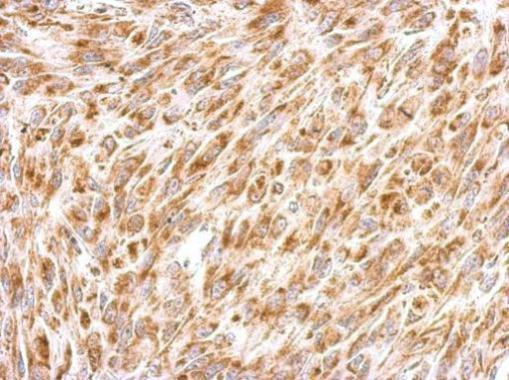 REA Antibody in Immunohistochemistry (Paraffin) (IHC (P))