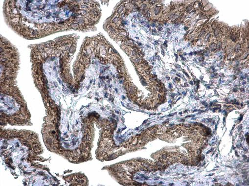 REA Antibody in Immunohistochemistry (Paraffin) (IHC (P))