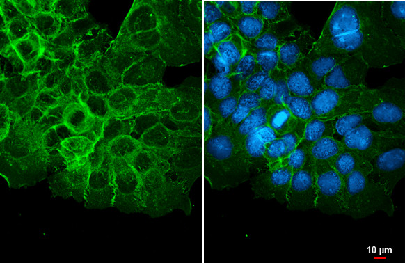 CD44 Antibody in Immunocytochemistry (ICC/IF)