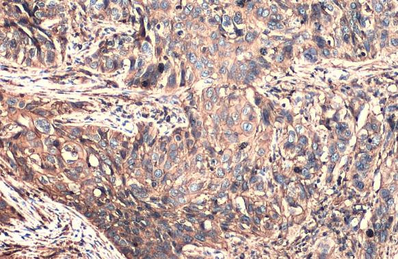 CD44 Antibody in Immunohistochemistry (Paraffin) (IHC (P))