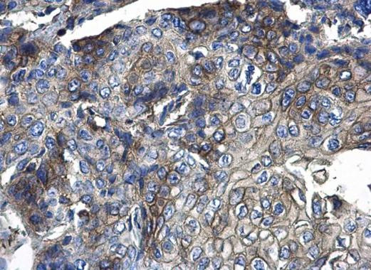 CD44 Antibody in Immunohistochemistry (Paraffin) (IHC (P))