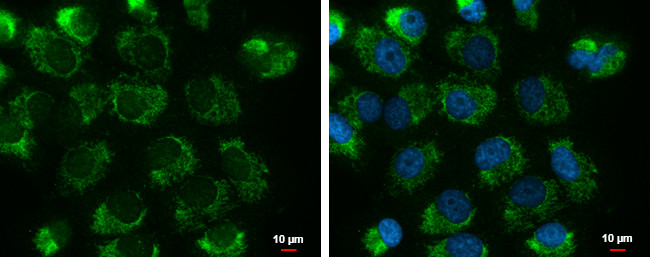 UQCRFS1 Antibody in Immunocytochemistry (ICC/IF)