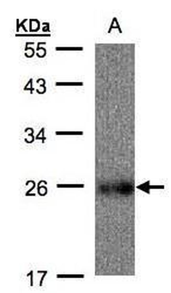 UQCRFS1 Antibody in Western Blot (WB)