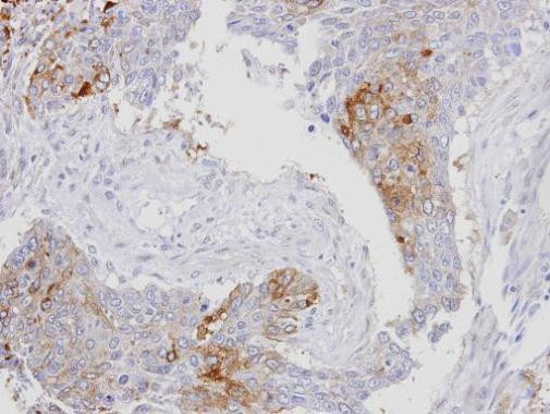 RanBP16 Antibody in Immunohistochemistry (Paraffin) (IHC (P))