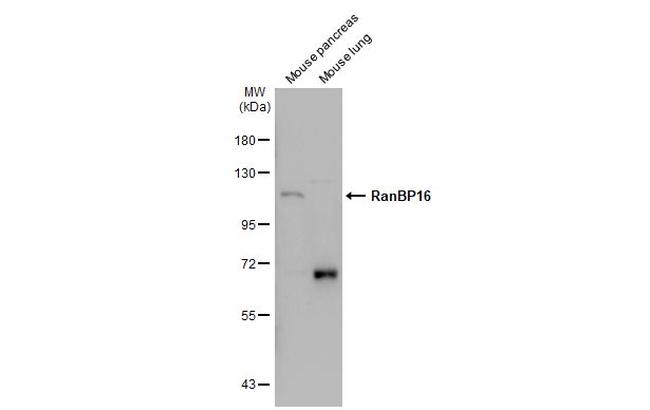 RanBP16 Antibody in Western Blot (WB)