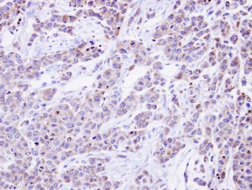 GANAB Antibody in Immunohistochemistry (Paraffin) (IHC (P))