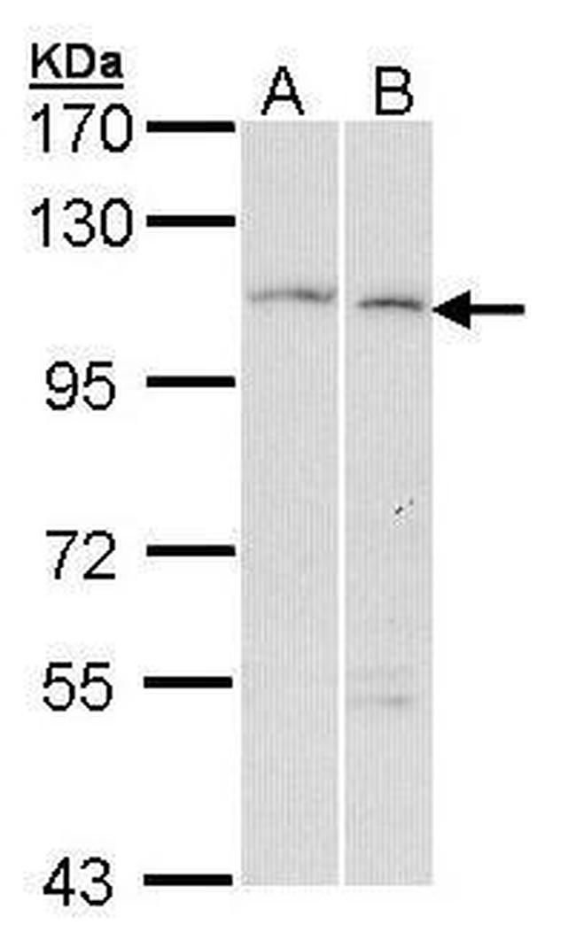 GANAB Antibody in Western Blot (WB)