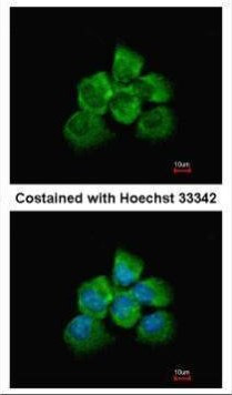 ARHGEF18 Antibody in Immunocytochemistry (ICC/IF)