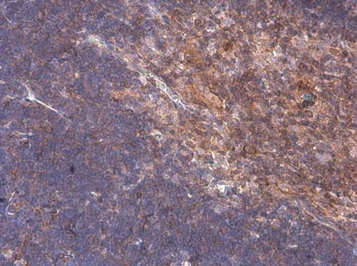 ARHGEF18 Antibody in Immunohistochemistry (Paraffin) (IHC (P))