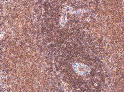 ARHGEF18 Antibody in Immunohistochemistry (Paraffin) (IHC (P))