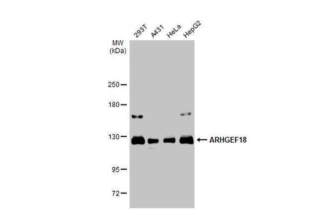 ARHGEF18 Antibody in Western Blot (WB)