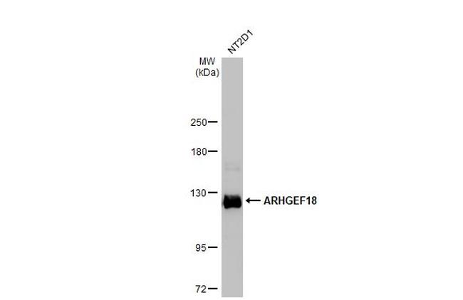 ARHGEF18 Antibody in Western Blot (WB)